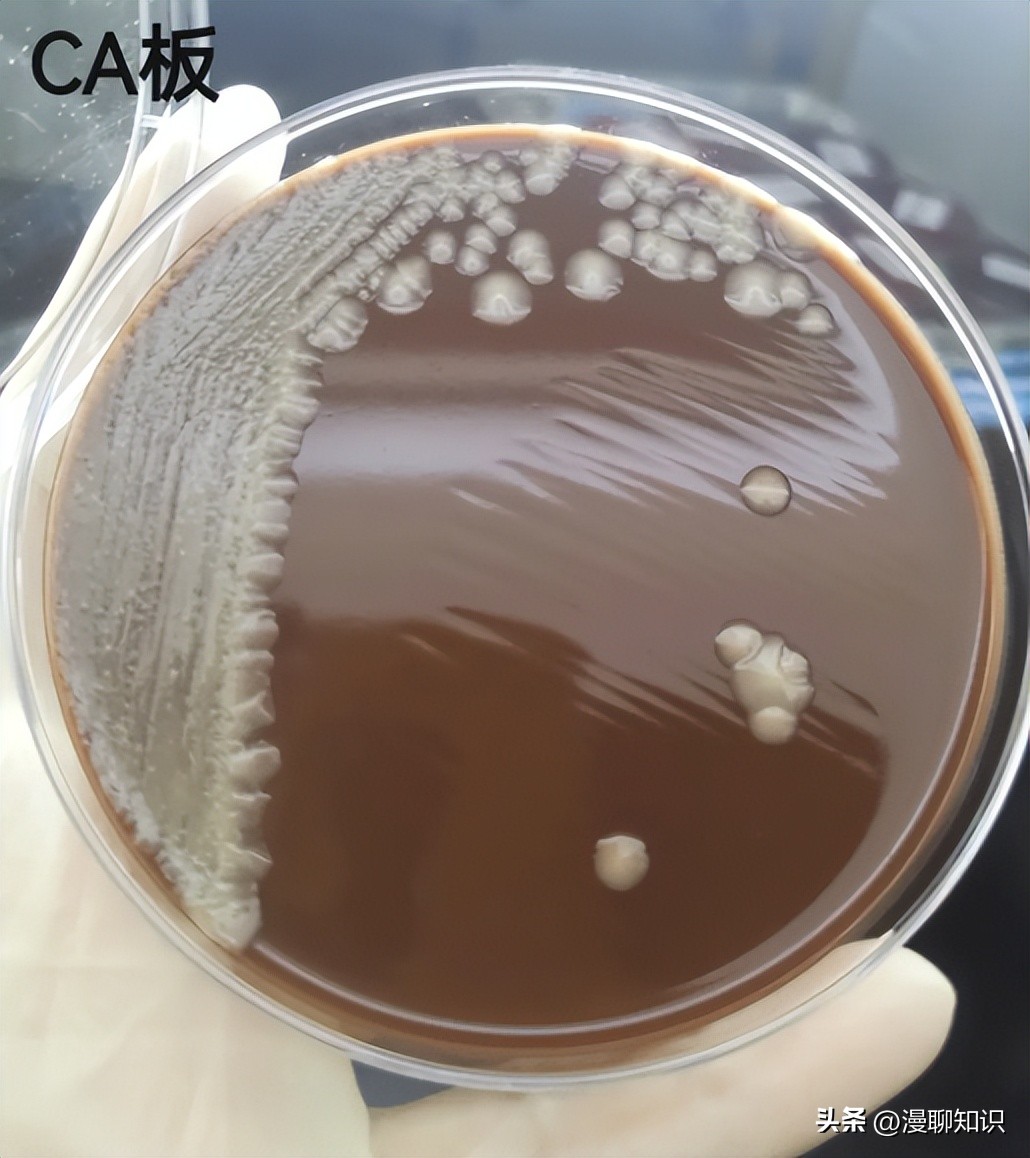 老年人得了肺炎应如何有效医治,肺炎有多严重怎么办