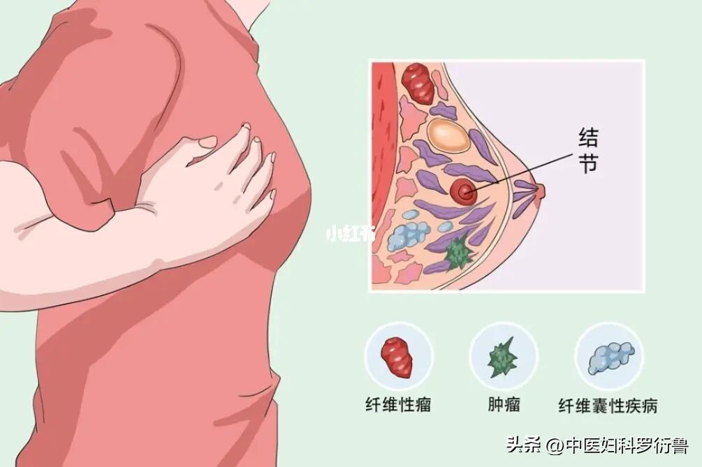 乳腺增生结节吃中药可以调理好吗,我乳腺结节3级为啥疼痛