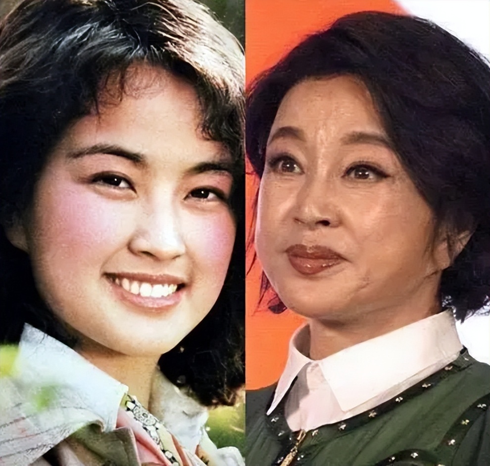 明星下颚骨整容后遗症,脸像鞋拔子怎么改善