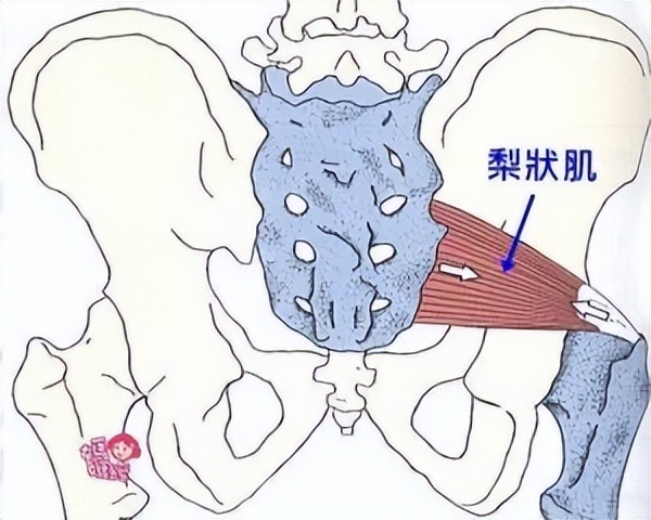 腰椎间盘突出压迫神经屁股疼腿疼,屁股两侧上方酸痛是不是腰椎突出