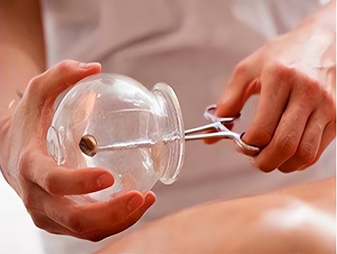 拔火罐时吸出来的淤血是毒素吗,拔火罐吸出来的瘀血是体内毒素