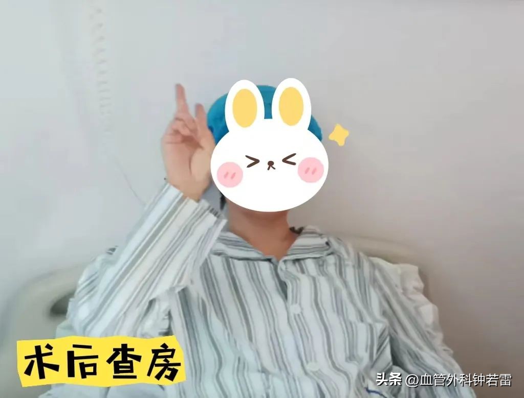 【静脉曲张案例34】61岁尹阿姨腿抽筋睡不着微创清零“小蚯蚓”