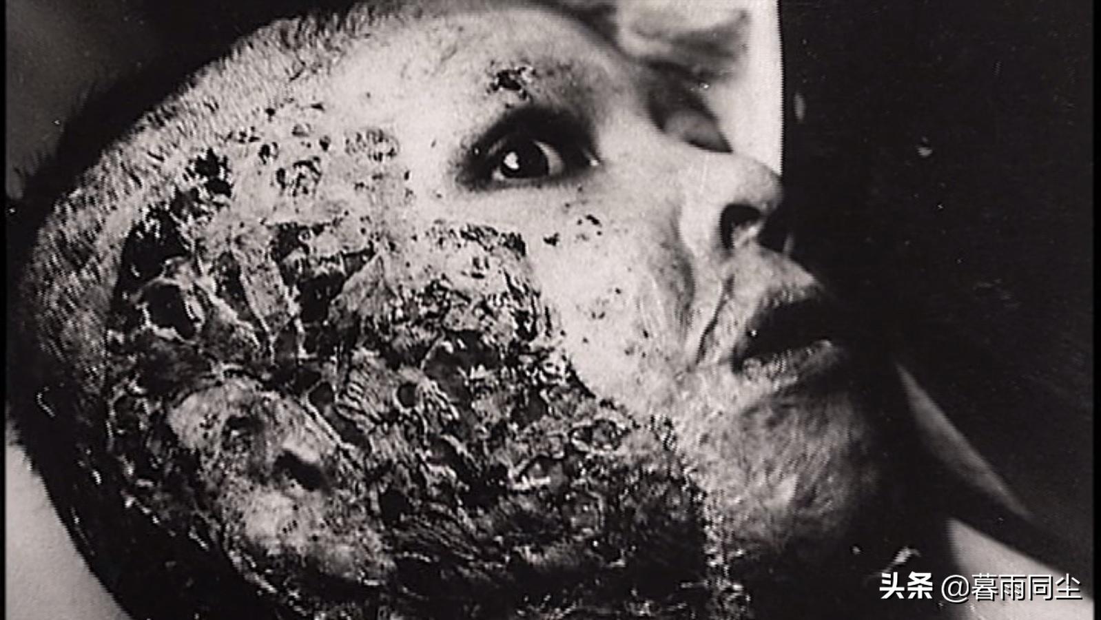 当你遭受核打击时,当受到伤害攻击该如何应对