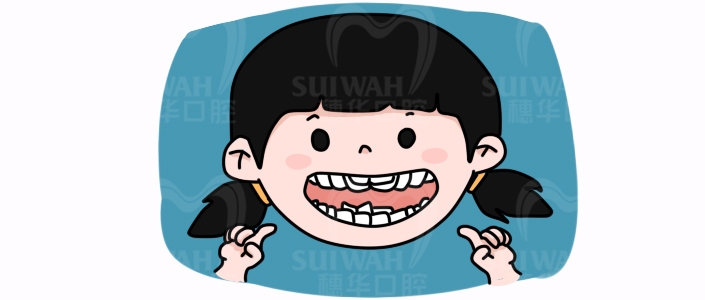 北大口腔医院儿童牙齿不齐矫正,儿童牙齿矫正北京大学口腔医院