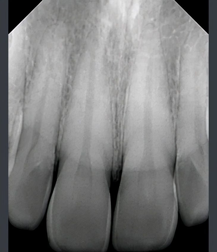 三星屏下光线感应器,三星sensor是测试什么的
