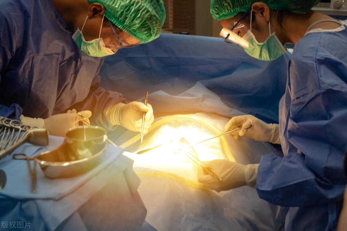 年轻人得了充满型胆囊结石怎么办,胆囊充满型结石十几年不切除