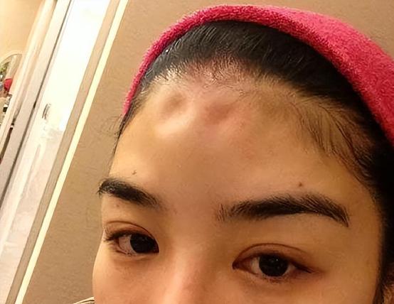 秦海璐澄清,秦海璐承认整容真的吗