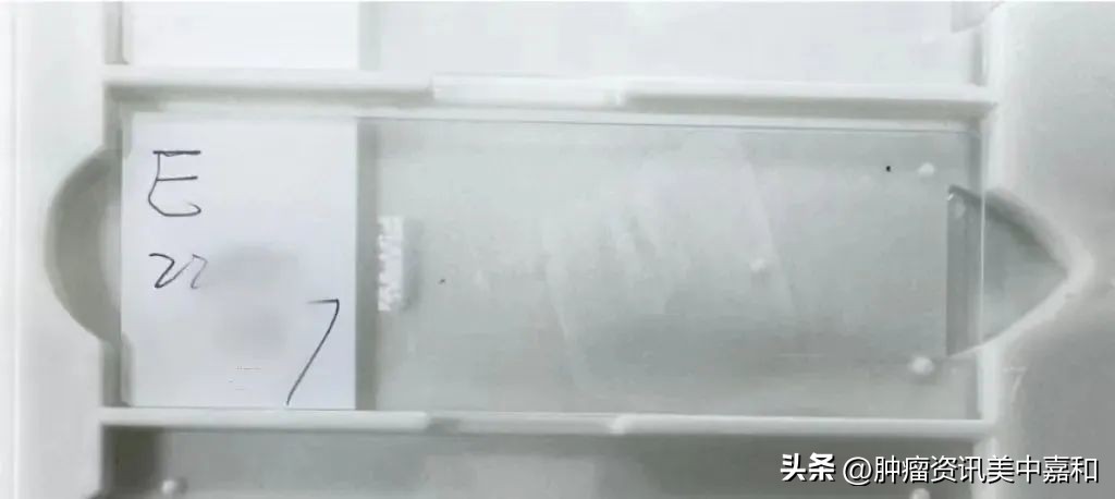 he切片和白片的区别,病理切片和白片的区别