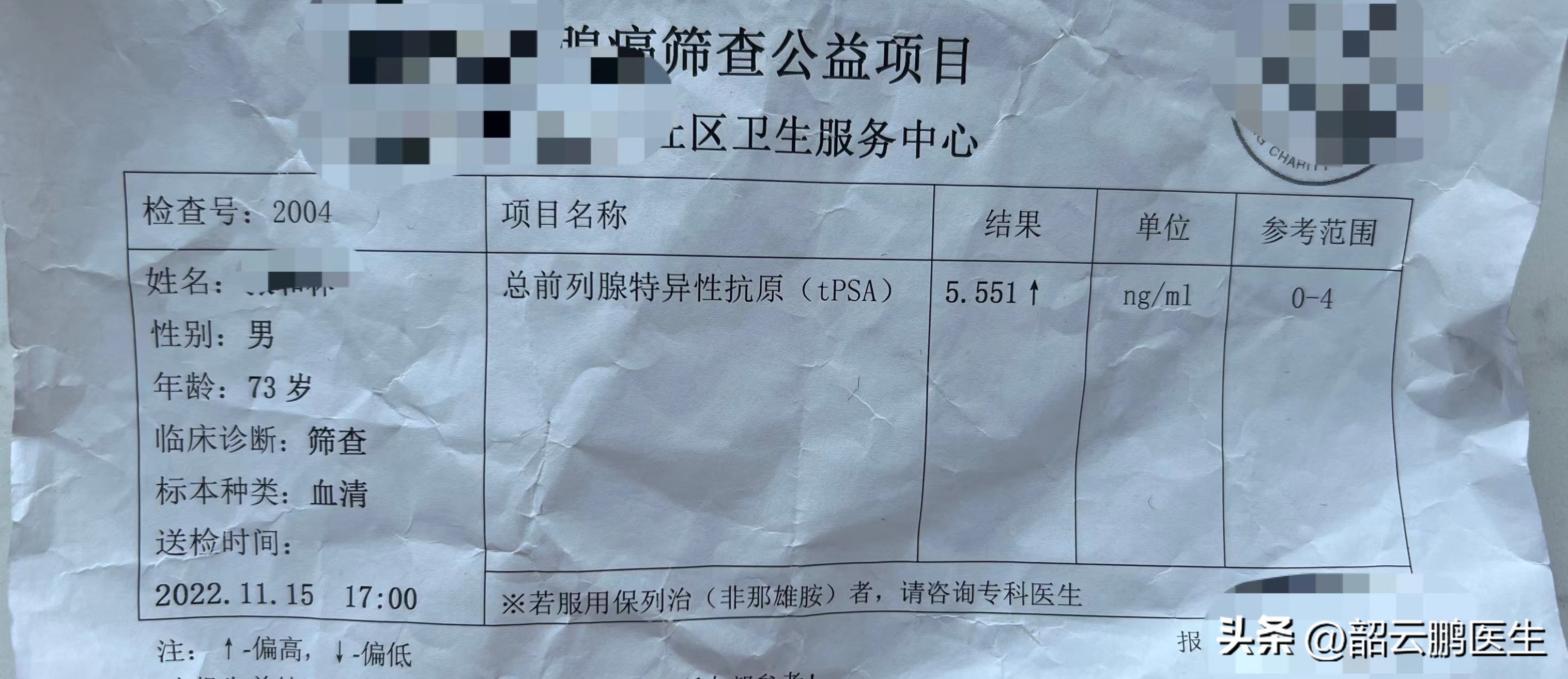 psa诊断早期前列腺癌的准确率,筛查前列腺psa需要空腹吗