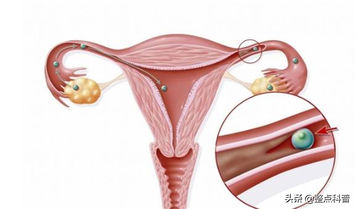 进入女性体内后，没成功“受精”的东西都去哪里了？既好笑又心疼
