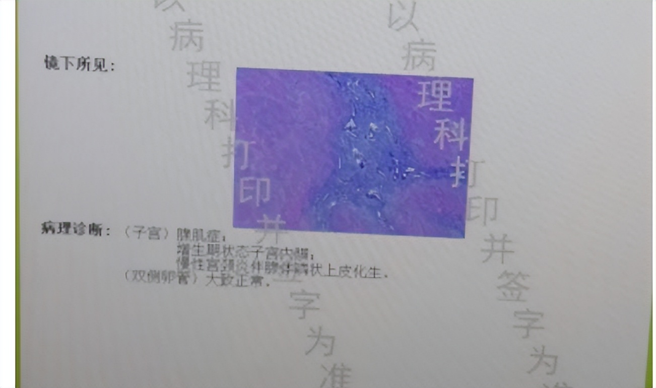 子宫腺肌症痛经厉害急诊怎么治疗,子宫腺肌症引起重度痛经