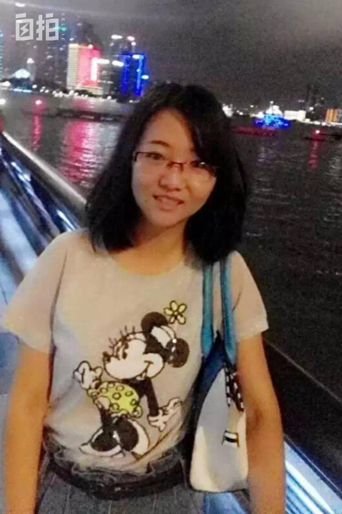 鍏堝ぉ鎬уけ鑱墜鏈垂澶氬皯,澶辫仾鎵嬫湳鎭㈠鍚姏