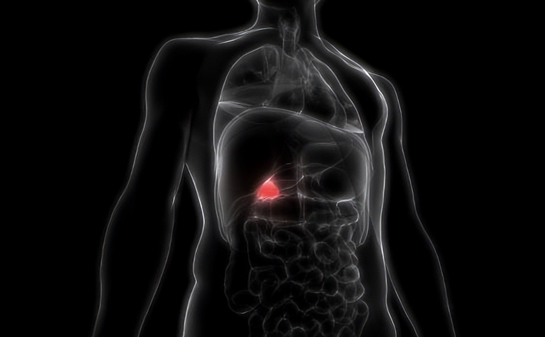 胆囊切除后遗症神经疼有办法治吗,胆囊结石切除胆囊后有什么后遗症
