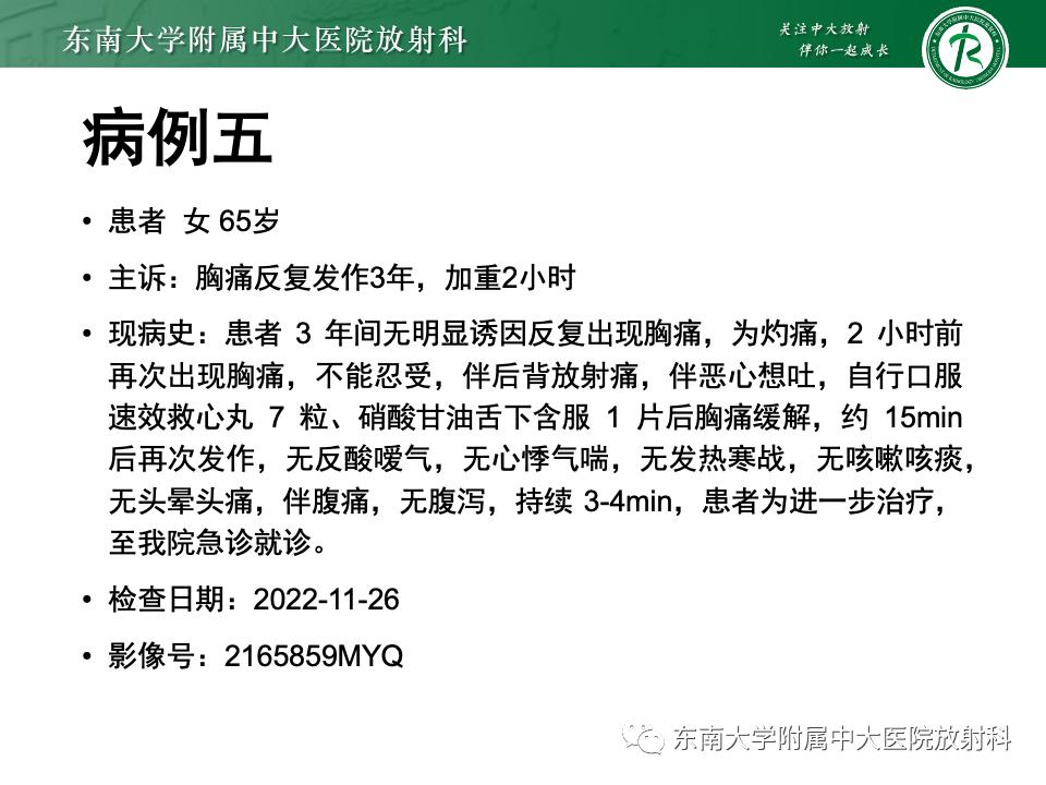 小肠间质瘤最新治疗中药方,小肠间质瘤基因检测