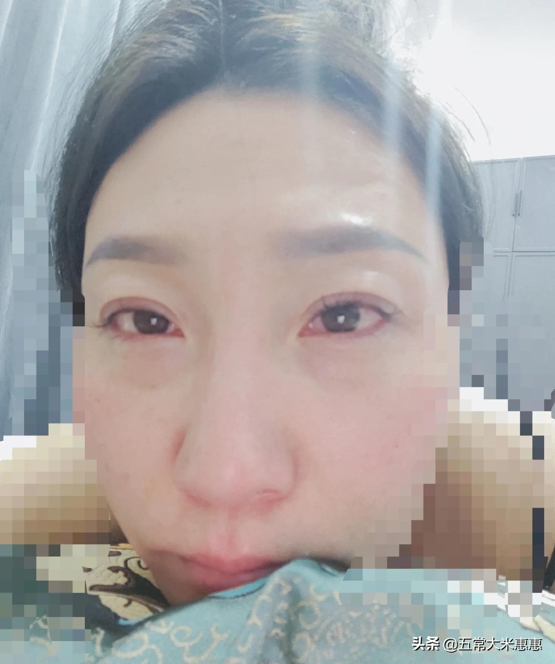 心脏支架后喘不上气,老人做完心脏支架后不能说话