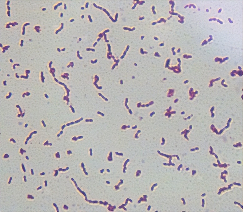 猪源链球菌的分离鉴定