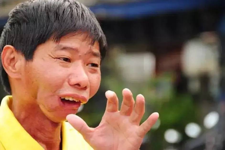 世界一级致癌物槟榔,一级致癌物槟榔有多恐怖