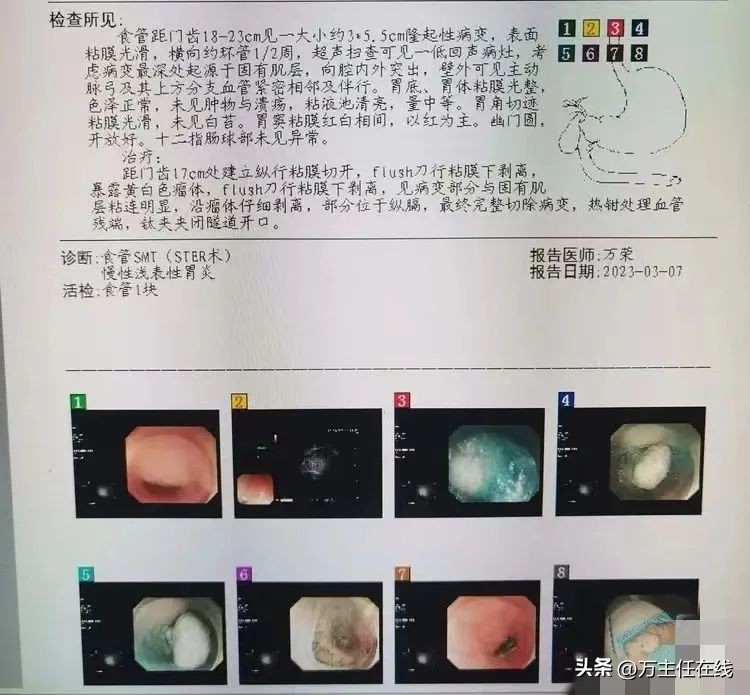 万荣教授上海市第一人民医院,消化内科专家手术