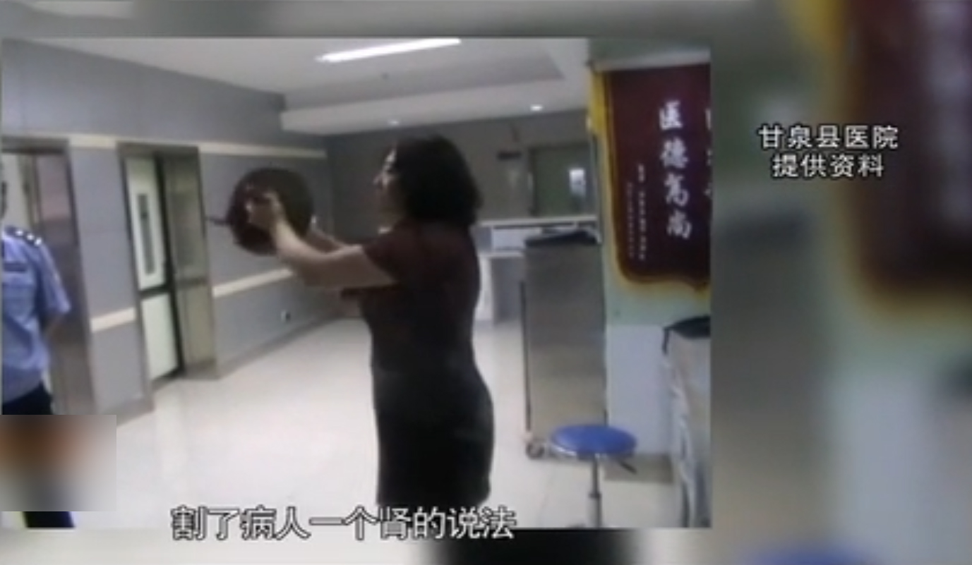 女子体检意外发现左肾不见了,偷切除左肾事件