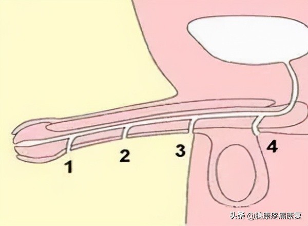 尿得特别远是怎么回事,尿分叉怎么锻炼