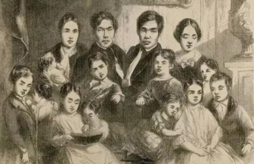 邦克兄弟连体人,连体人怎么进行生育