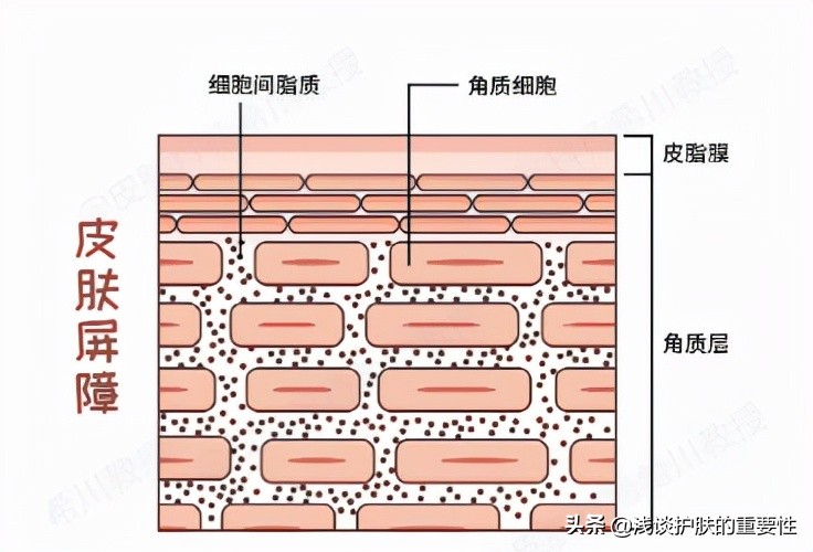 角质层薄有红血丝最好的修复方法,鼻子周围角质层薄泛红血丝