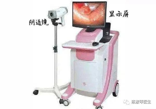 阴道镜检查是怎么回事？
