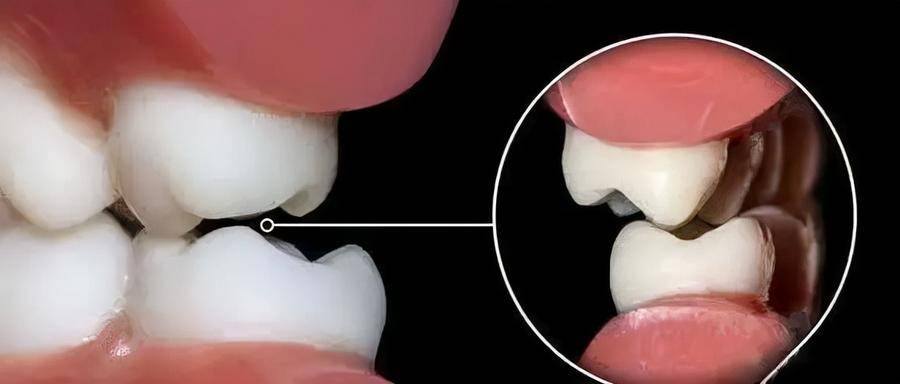 国民初恋毁容了,国民初恋盛世美颜