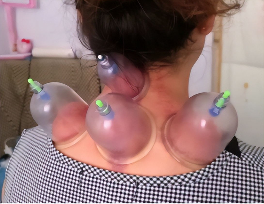 经常头晕中医怎么辨证,头晕中医可以根治吗