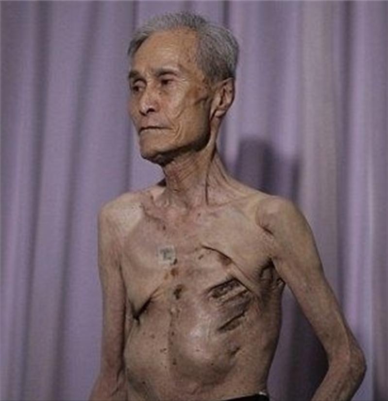 原子弹爆炸后怎么自救,原子弹爆炸如何自救保命