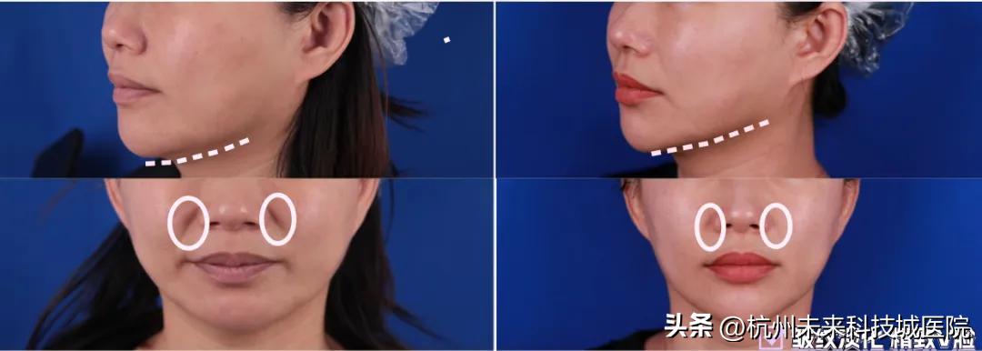 不追求一个模板的复制美|17年专注年轻化专家