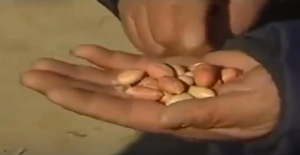 河北女孩瘫痪,河北女子瘫痪在床20年