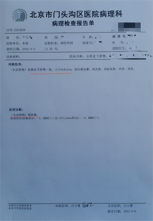 神经外科切除头皮脂肪瘤,脂肪瘤外科门诊手术