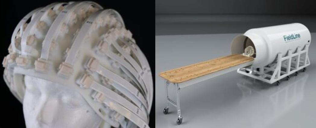 深度探究脑科学记忆5个硬核方法,脑电图基础知识科普最全图文并茂