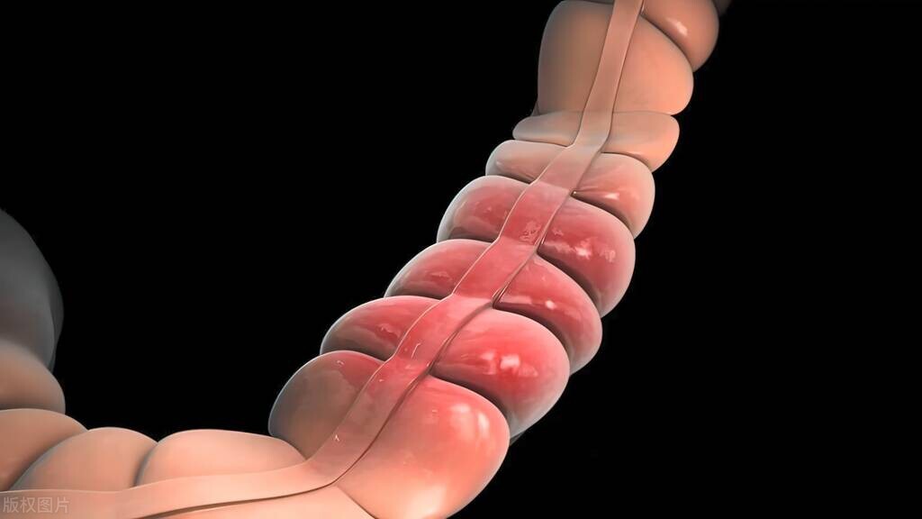 痔疮经常便血会不会有生命危险,痔疮切了还会便血吗