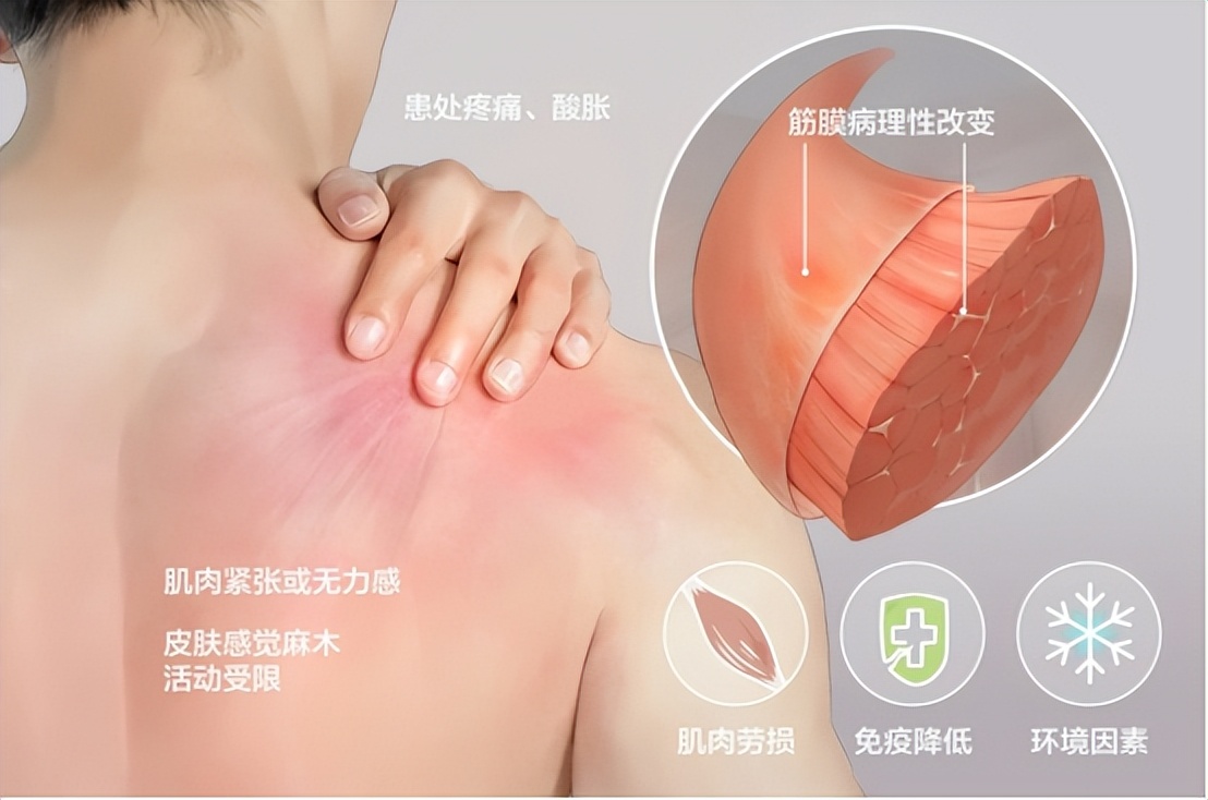 筋膜枪的作用和危害,筋膜枪的三大危害禁忌