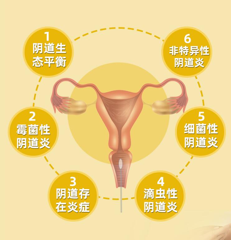女性怎么自测妇科病,女性妇科病怎么样检查
