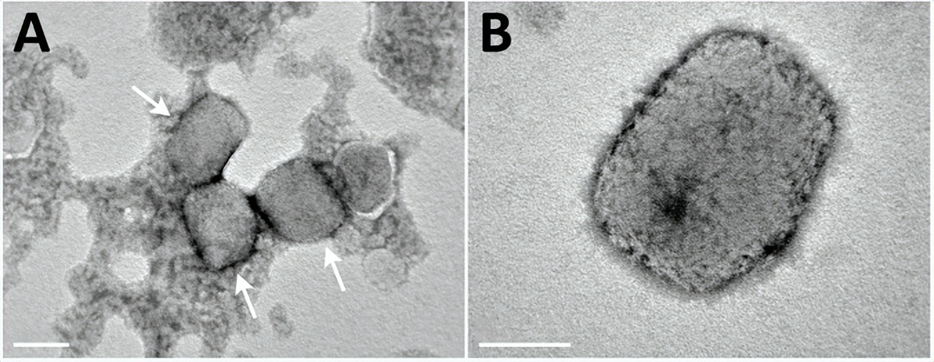 who危险度等级,who风险级别