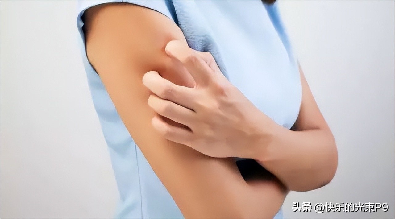 对自己的汗水过敏是多么痛苦