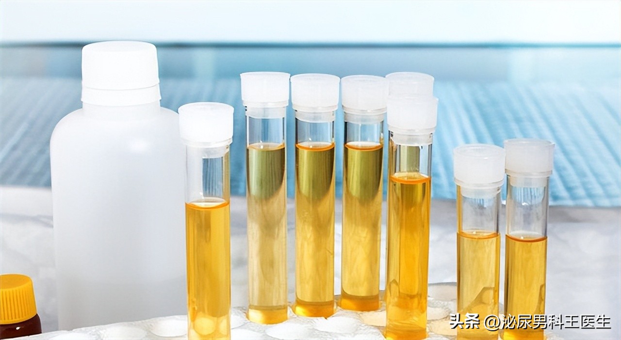 排尿很黄、异味很大？身体向你暗示的这3件事，可能与疾病有关