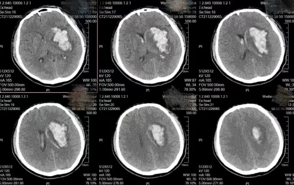 拼手速抢名额,拼手速收能量