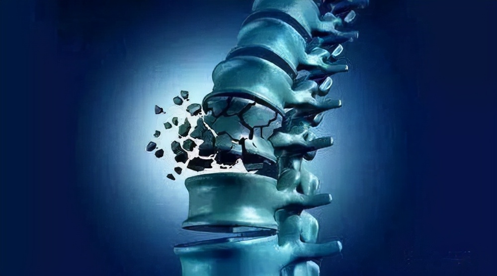 更年期女性浑身疼痛是怎么解决,更年期女性为什么有的浑身难受