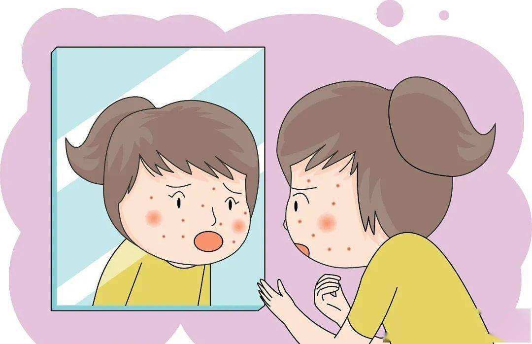 吃辣长痘真相原来是在这里,吃辣长痘是因为吃油多吗