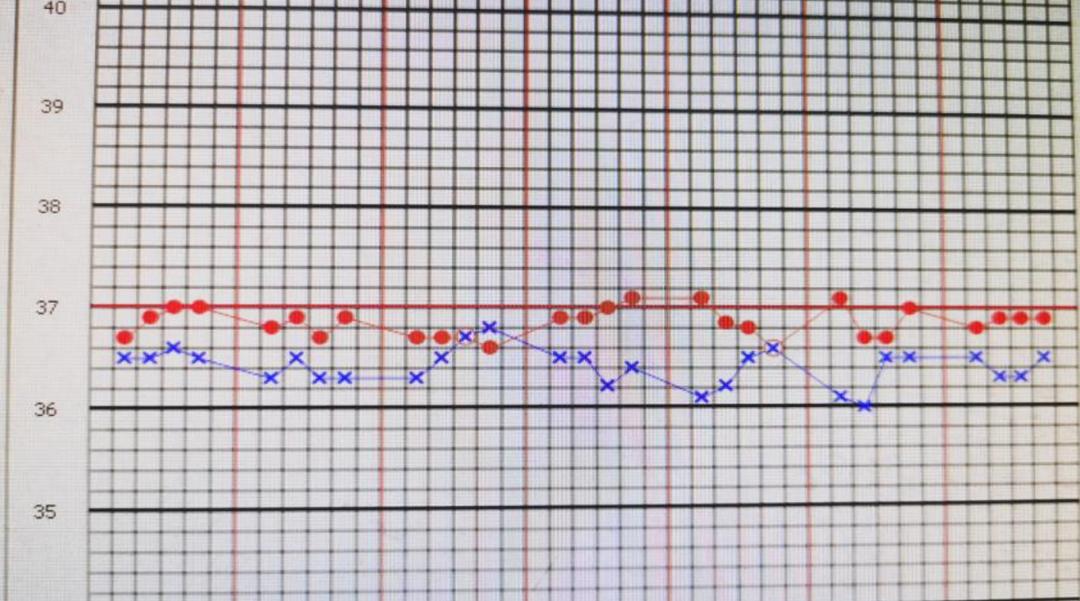 感染后稍微活动喘胸闷心悸,pjp感染