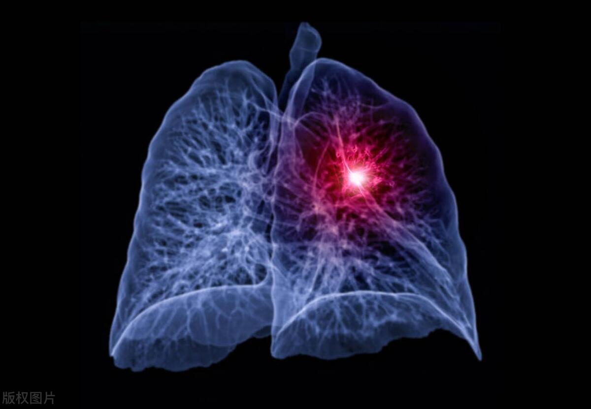 体检发现的23个异常不用担心,体检异常不要慌