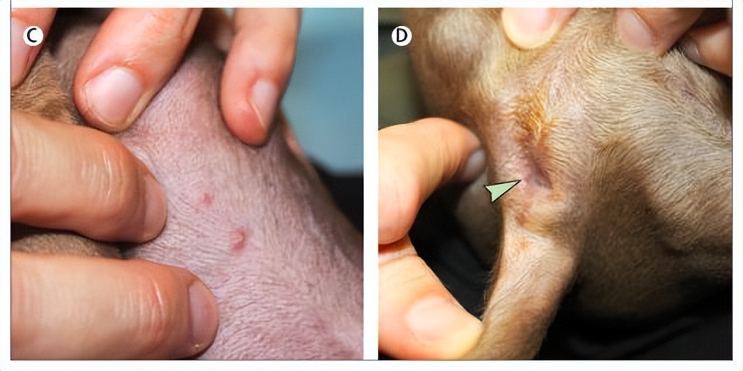 omicron鍥戒骇鐤嫍,omicron鐤嫍