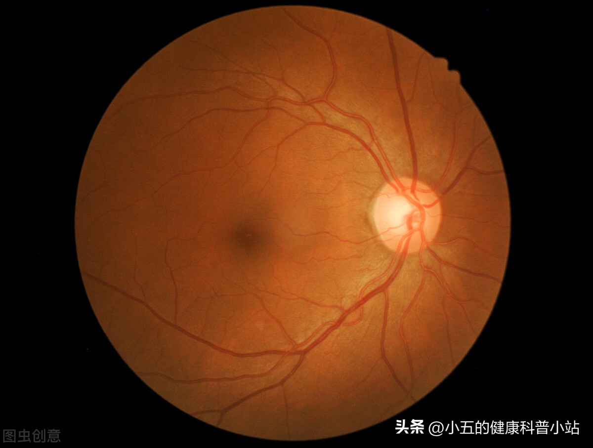 吃维生素a可以改善视力么,吃维生素a的食物能让视力变好吗