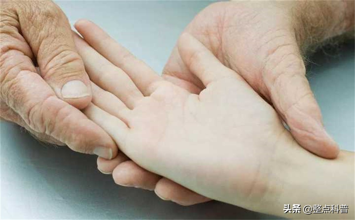 民间断掌纹说法,断掌纹与先天疾病