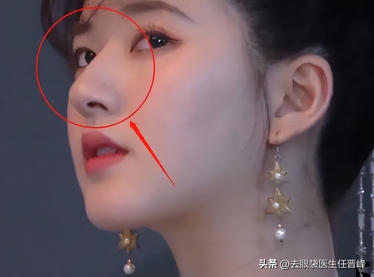 三甲医生大公开，“神颜港姐冠军”拥有这几点，也也可以很美