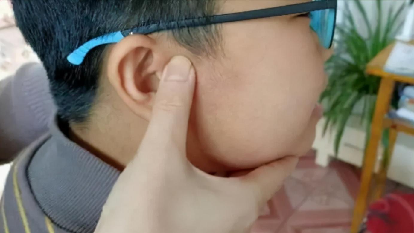 小孩身上有小红点抹啥药,孩子身上起了一个化脓性肉芽肿